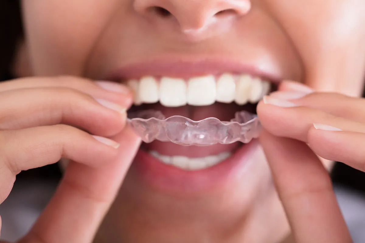 Diseño Sonrisa